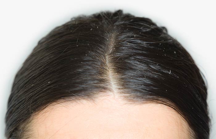Hair smoothing methods cause greasiness