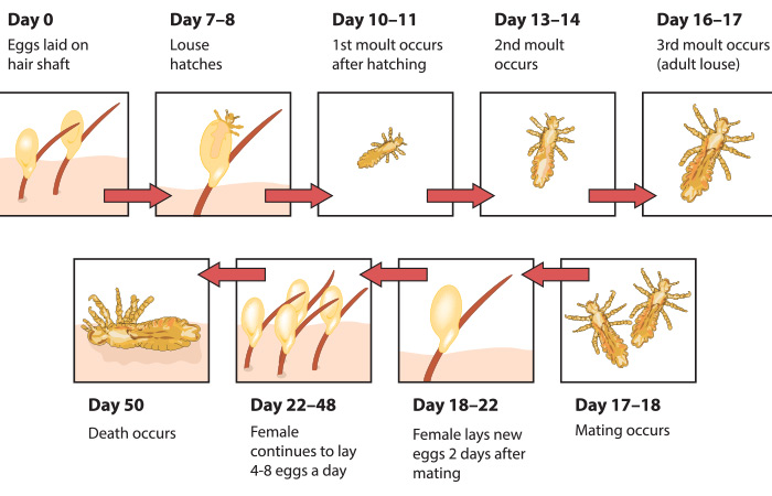 Head lice life cycle in picture from day 1 to day 18